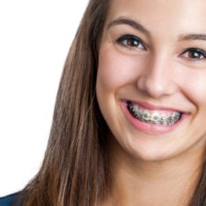 Girl with braces