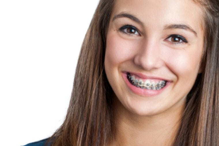 Girl with braces