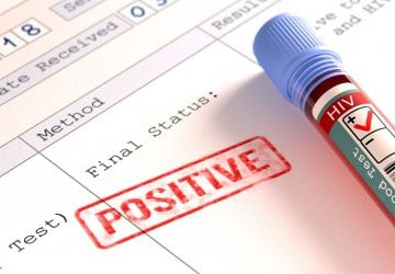 test results for HIV