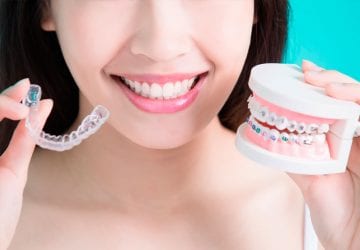 woman showing off different types of braces