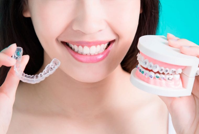 woman showing off different types of braces