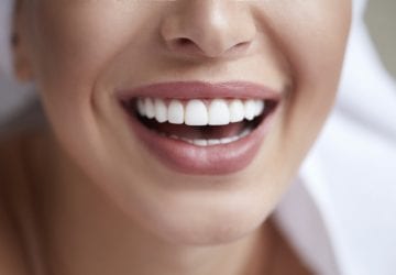 woman smiling with dental veneers