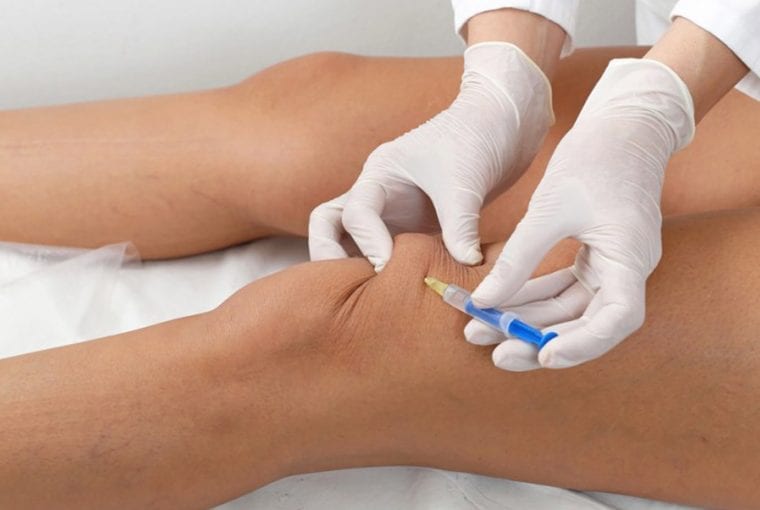 joint injections