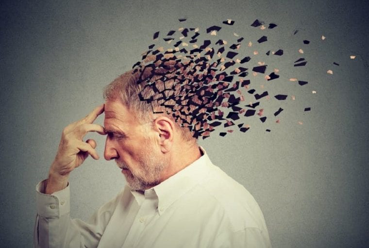 alzheimers