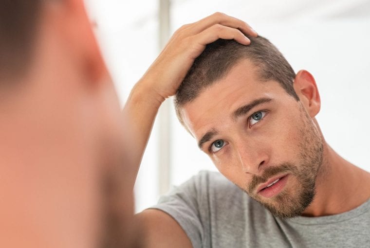 hair loss