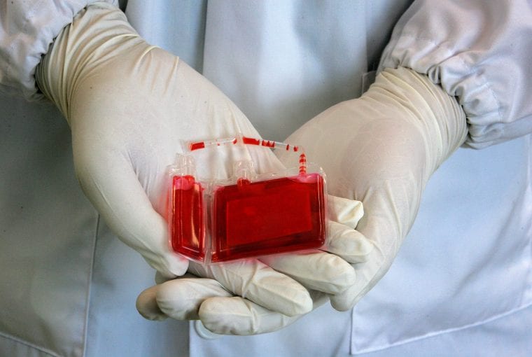 cord blood banking