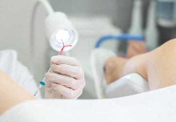 a doctor inserting an IUD