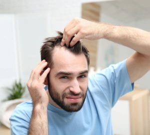 a man checking his hair loss