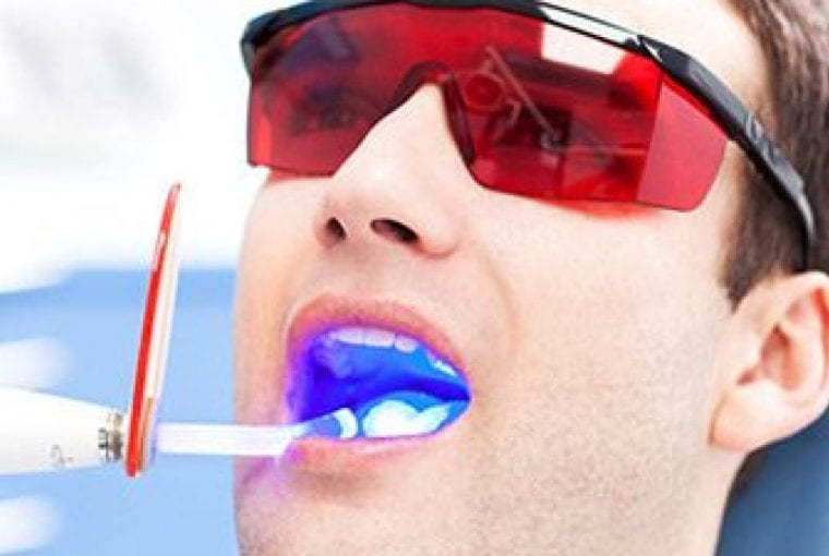 a man getting teeth whitening