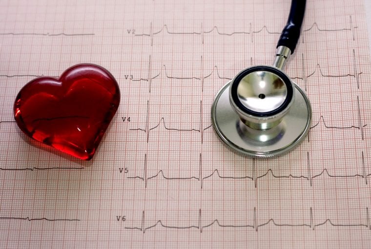 a stethoscope on an EKG