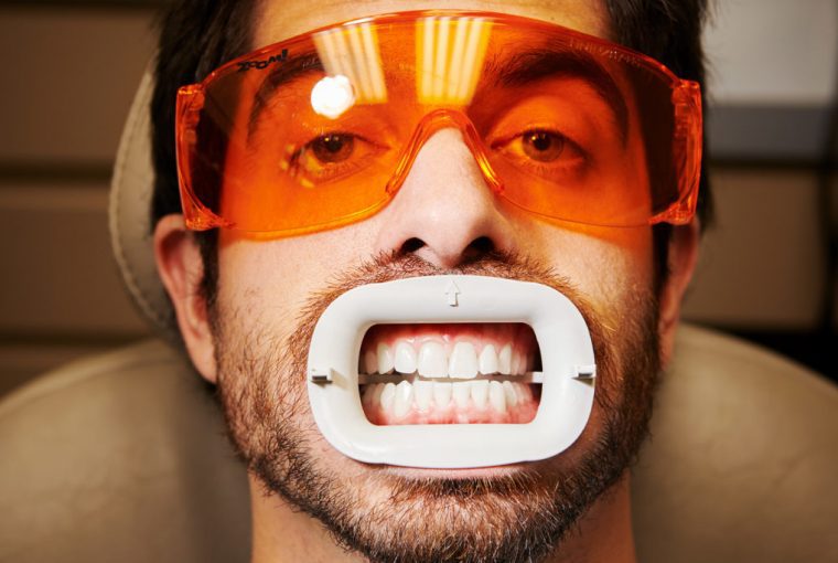 teeth whitening