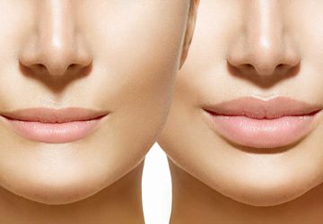 a pair of women with full lips