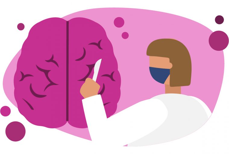 illustration of a brain surgery