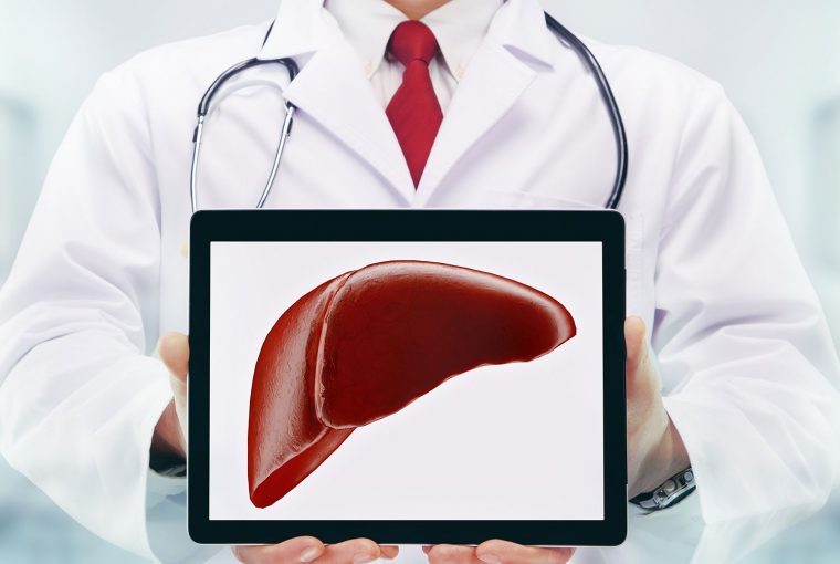 a doctor holding an image of a liver