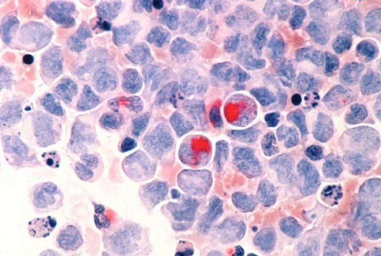 an assortment of healthy and cancerous cells