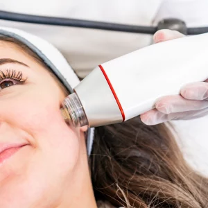 a woman getting a micro needling procedure