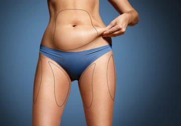 a woman holding loose skin on her abdomen