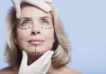 a woman with lines on her face for a facelift surgery